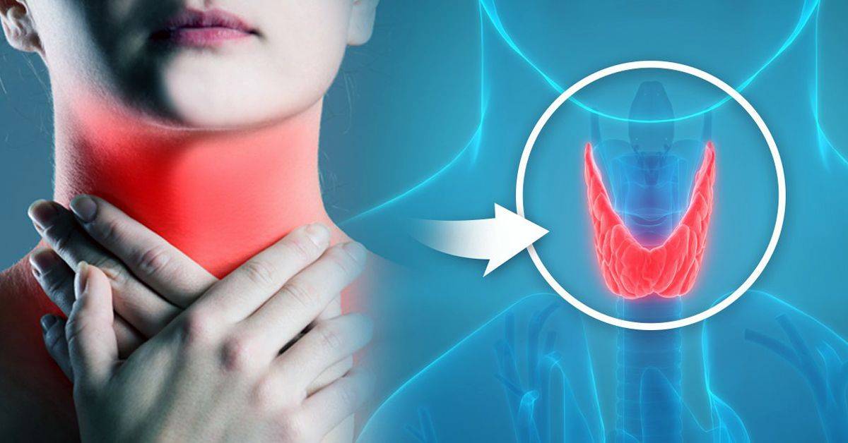 Лишний Вес И Заболевание Щитовидной Железы
