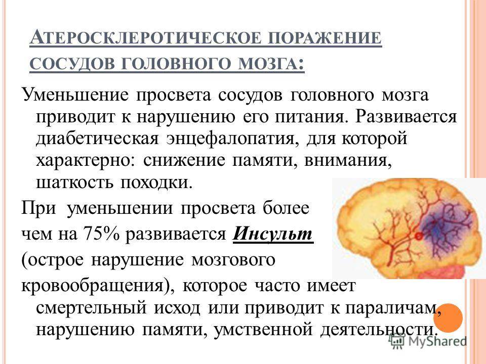 Диета При Атеросклерозе Сосудов Мозга