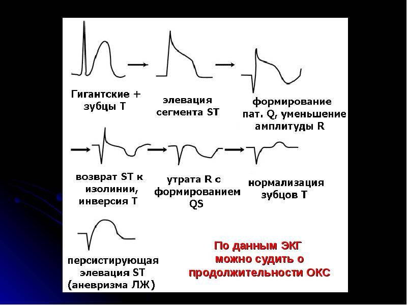 Карта вызова c окс c подъемом сегмента st