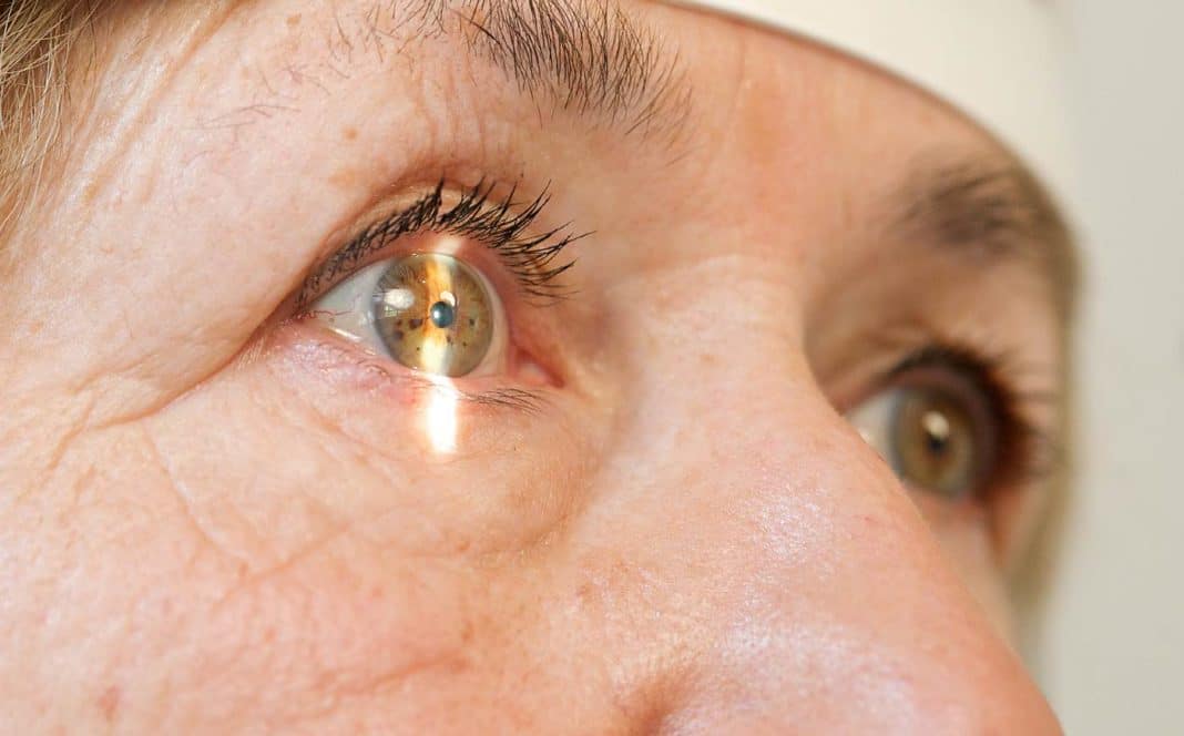 Лечение катаракты без операции лекарственными средствами