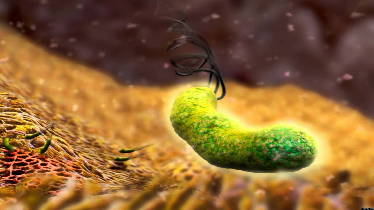 Бактерия хеликобактер: симптомы, причины и лечение