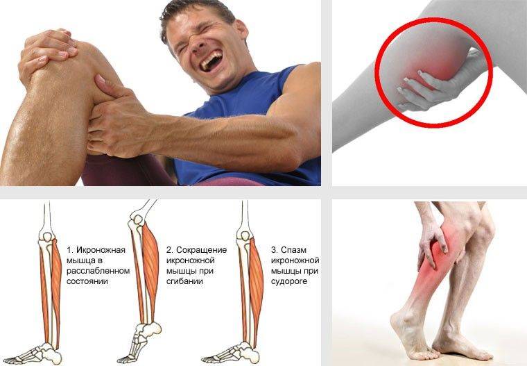 Причины и лечение судорог икроножных мышц. боль в ноге после судороги