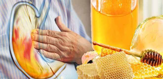 Мед при гастрите: можно ли, польза и противопоказания