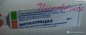 Хейлит на губах: лечение мазью | marykay-4u.ru