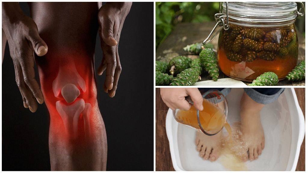 Мазь от боли в суставах коленей: перечень, чем мазать, причины и лечение