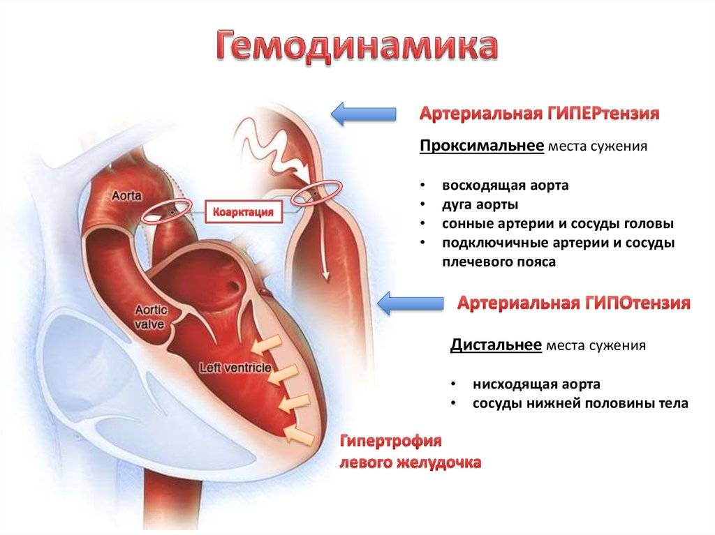 Аортальная регургитация клапана (1 степени): что это такое, причины