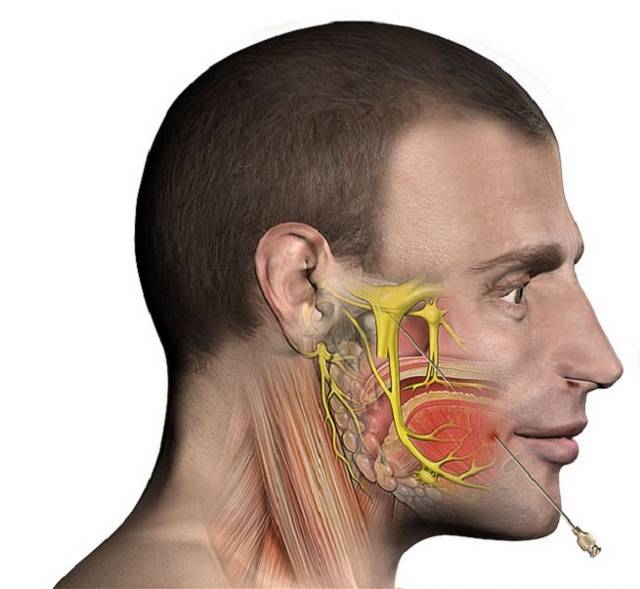 Чем опасно воспаление тройничного нерва? симптомы и лечение невралгии ушного узла