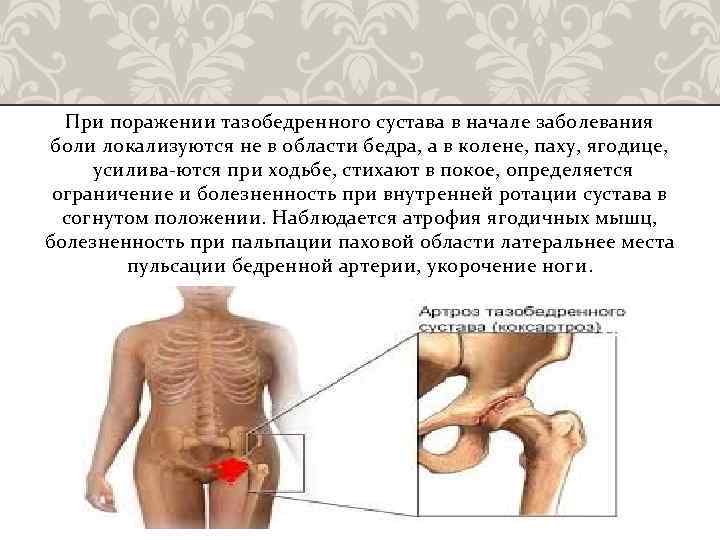 Болит внизу паха слева у мужчин. Болит в области тазобедренного сустава. Боль в тазобедренном суставе спереди. Локализация боли при воспалении тазобедренного сустава. Болит левый тазобедренный сустав.