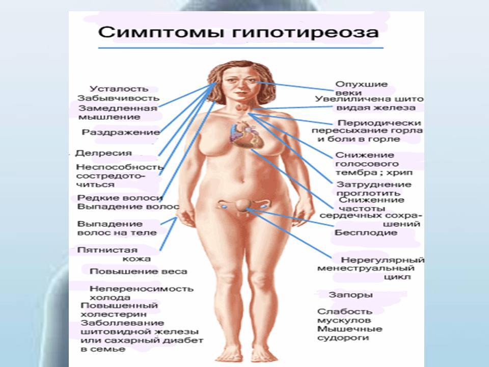 Гипотиреоз в менопаузе: симптомы у женщин, формы заболевания щитовидной железы, лечение медикаментами, народными средствами
