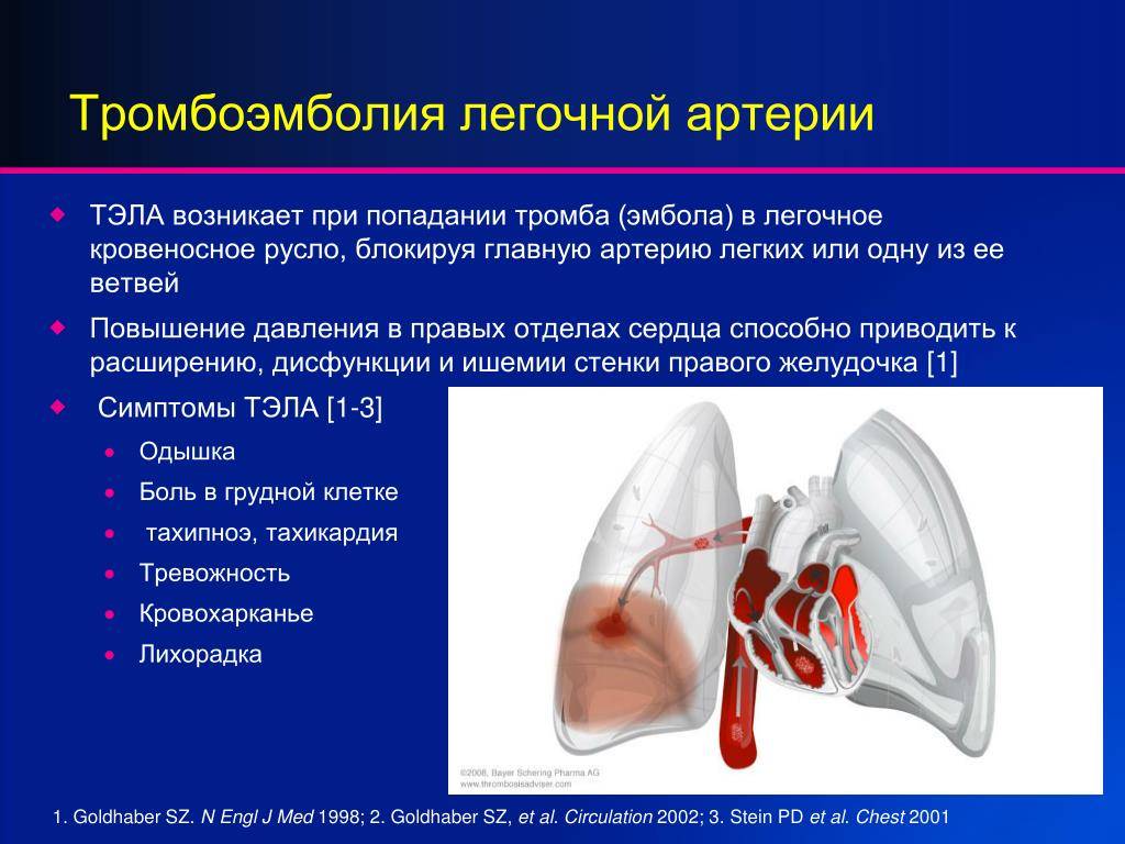 Тромб в правом. Эмболия легочной артерии симптомы. Патогенез тромбоэмболия ветвей легочной артерии. Тромбоэмболия легочной артерии клиника. При тромбоэмболии легочной артерии развивается.