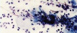 Бактерии типа leptotrix что это? симптомы, лечение и профилактика