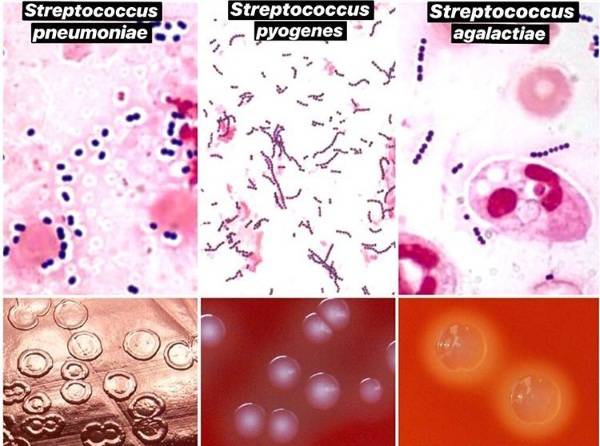 Streptococcus spp и agalactiae в мазке у женщин