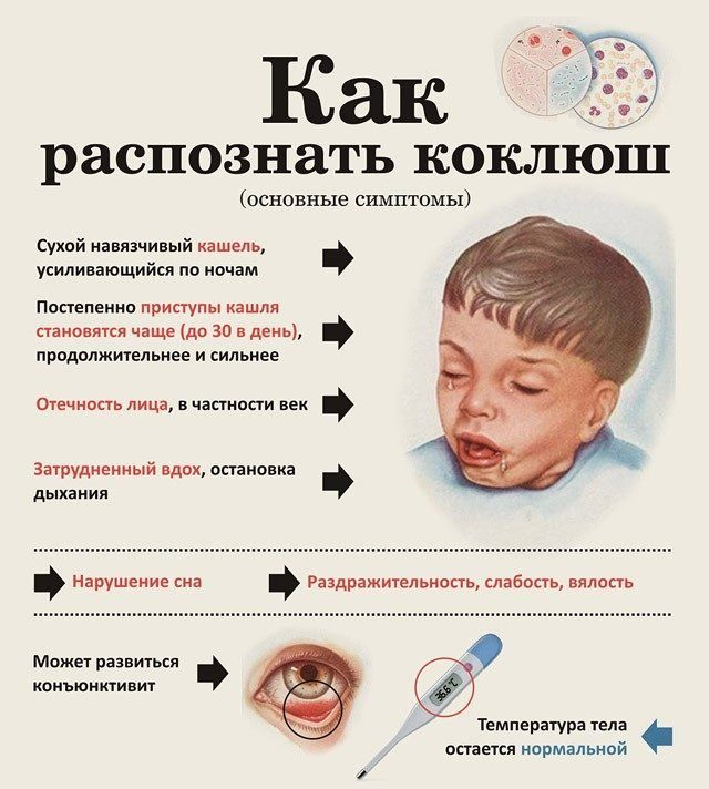 Паракоклюш. симптомы у детей, взрослых, что это такое, признаки, лечение, клинические рекомендации