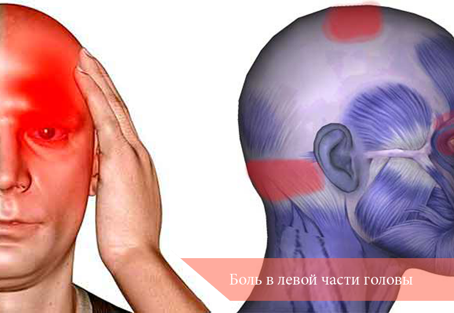 Грамотное поведение когда болит затылок и шея: причины, симптомы и лечение заболевания.