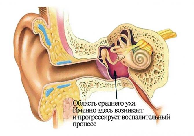 Болит горло и закладывает уши: симптоматика и эффективное лечение