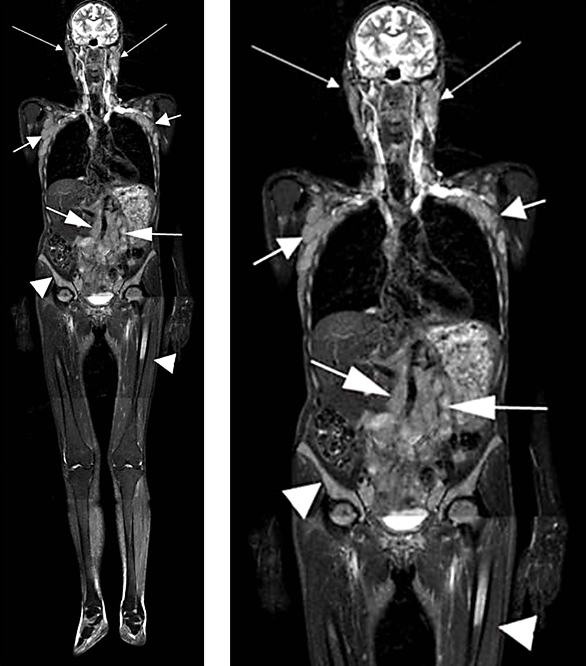 Разница кт и кт с контрастом. Мрт кт рентген. Компьютерная томография и магнитно-резонансная томография. Магнитно-резонансная томография мягких тканей (1 зона) это. Магниторезонансная томография (мрт).