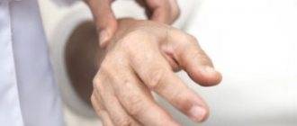 Тремор рук пожилых людей — причины, лечение, симптомы