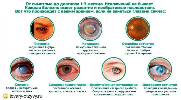 Вам поставили диагноз глаукома? что это за болезнь, 5 первых признаков патологии