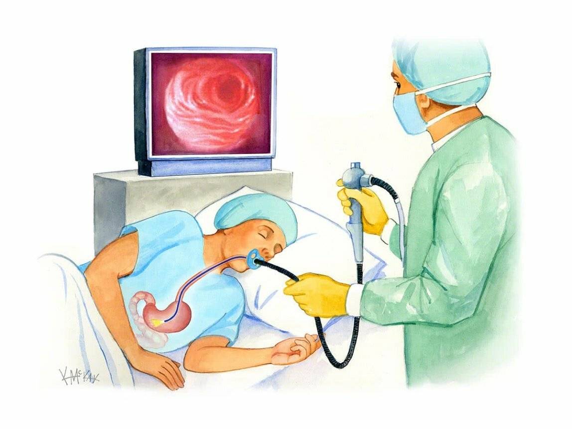 Гастроскопия желудка - как проводится, как подготовиться, правила питания - больвжелудке