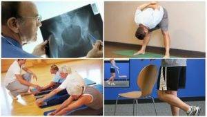 Упражнения при остеоартрозе плечевого сустава
