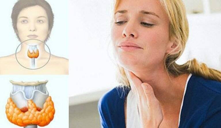 Заболевания щитовидной железы у мужчин: симптомы, лечение и профилактика