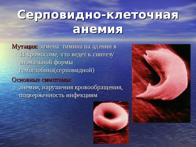Серповидно-клеточная анемия — большая медицинская энциклопедия