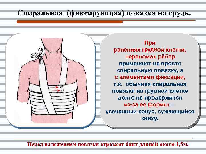 Первая медицинская помощь при переломе ребер. Спиральная повязка на грудную клетку при переломах. При переломе ребер повязку на грудную клетку накладывают в состоянии. Травма грудной клетки перевязка. Спиральная повязка при переломе ребер.