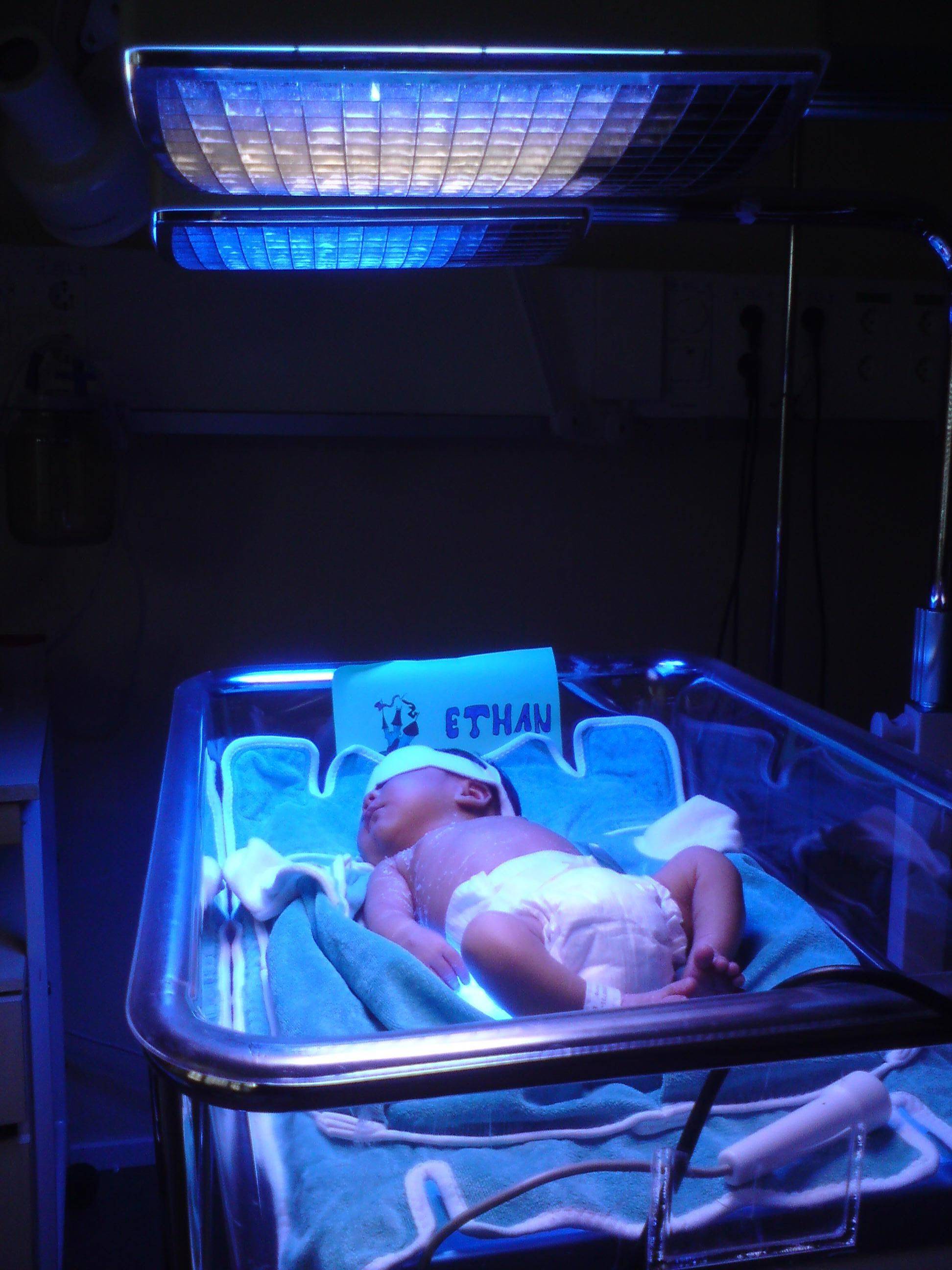 Фототерапия новорожденных при желтухе: фотолампа и облучитель, фотолечение, лампа - сколько дней ставят