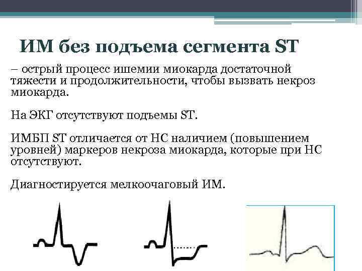 Карта вызова c окс c подъемом сегмента st