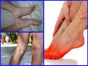 Боль в ногах – 14 возможных причин