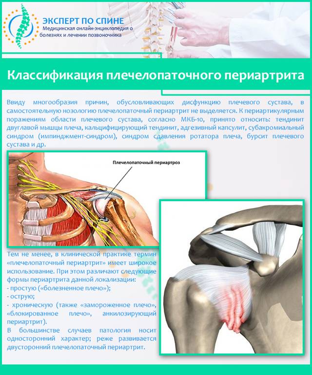 Лечение остеоартроза коленного сустава 2 степени, причины и симптомы заболевания