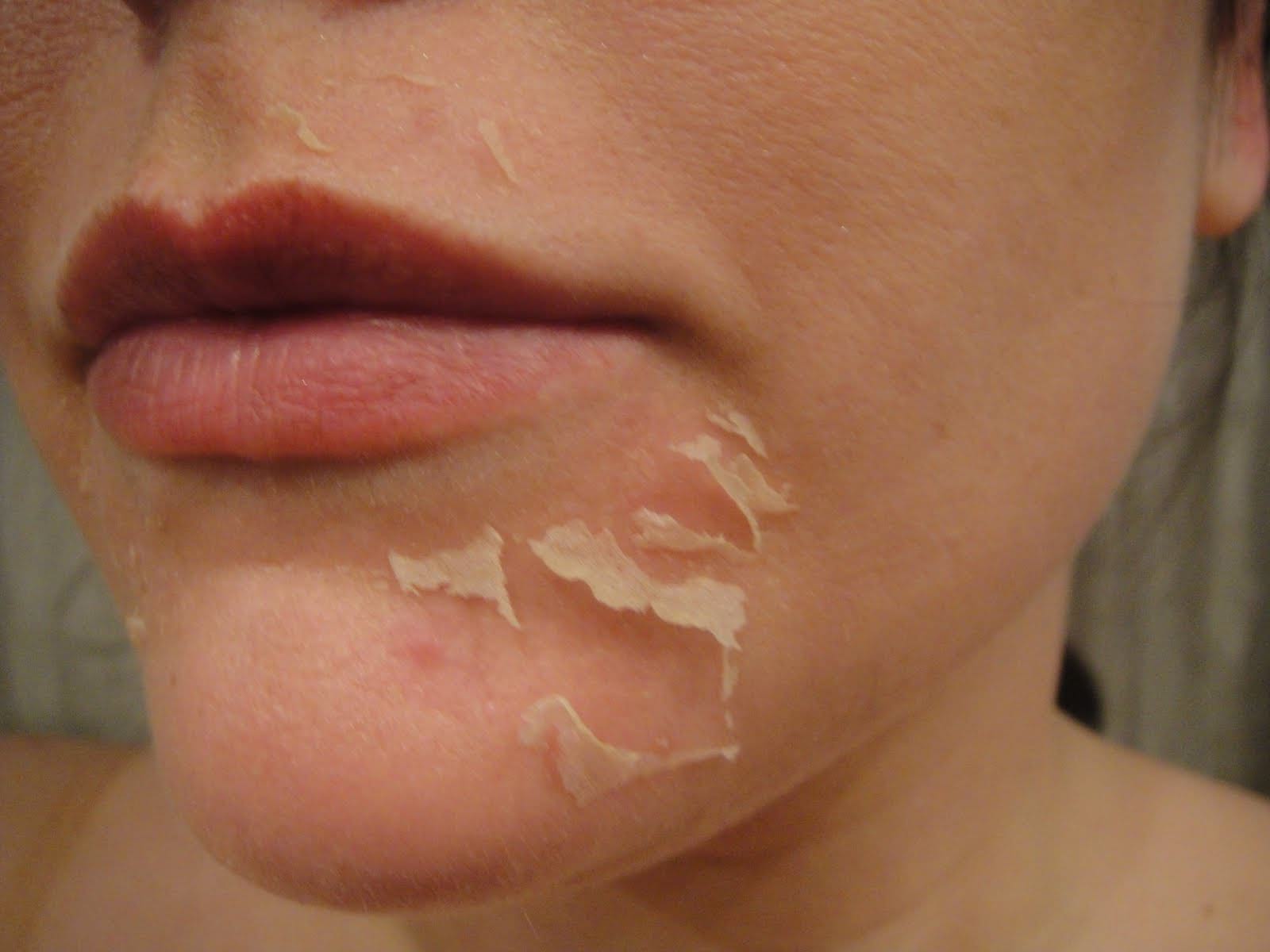 11 масок от шелушения кожи лица в домашних условиях