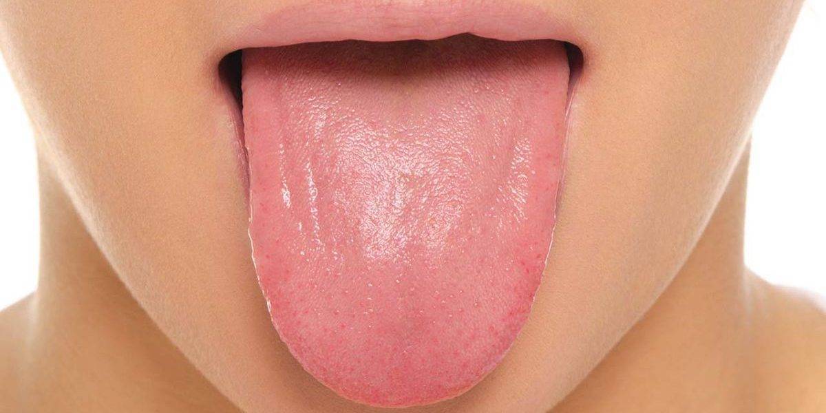 Щиплет язык: причины появления недуга и способы лечения