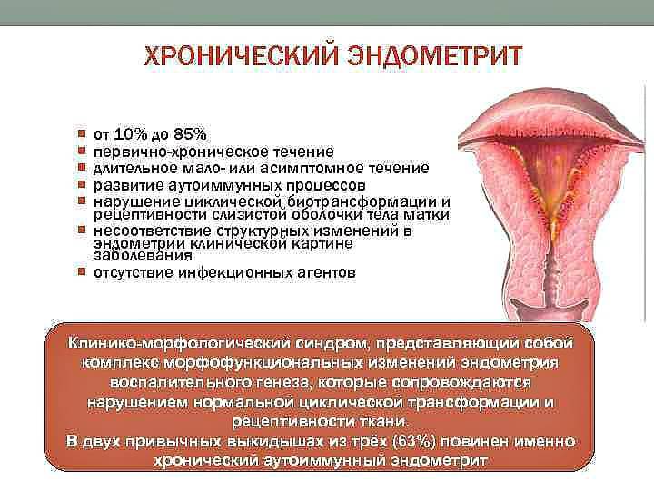 Эндометрит | симптомы | диагностика | лечение - docdoc.ru