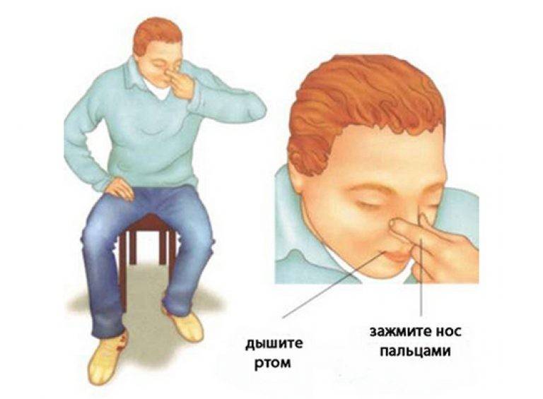 Как сделать, чтобы пошла кровь из носа — без боли, в домашних условиях