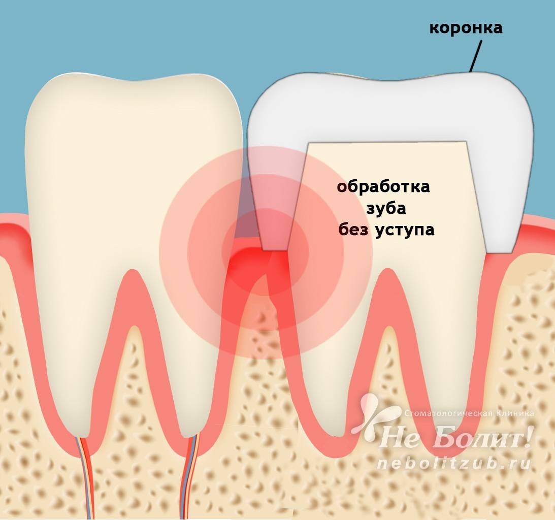 Как уменьшить боль в зубе