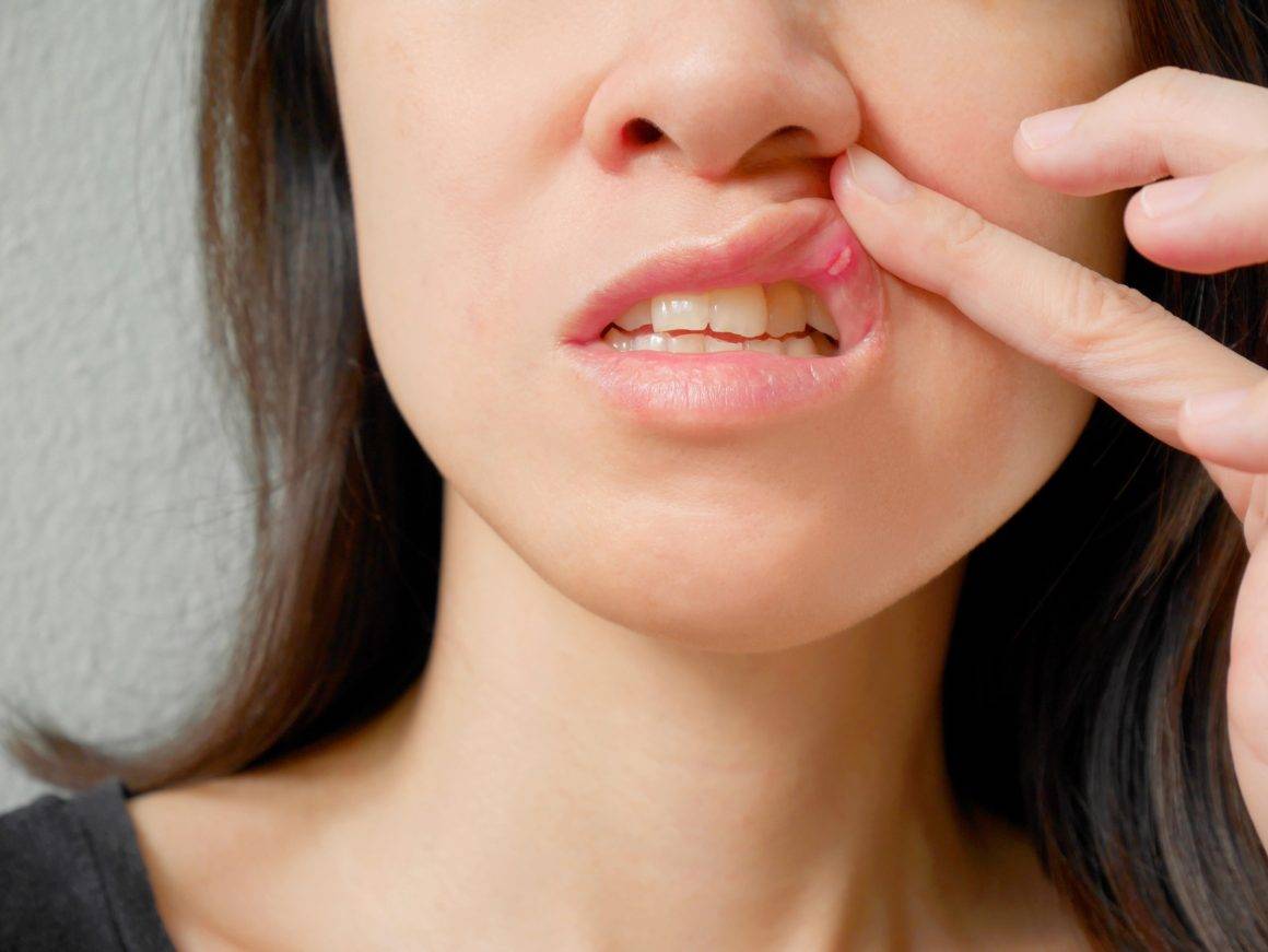 Привкус металла во рту: причины металлического вкуса, особенности у женщин и мужчин, что это означает