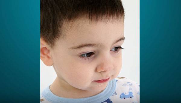 Почему у ребенка синяки под глазами и когда это причина патологии, требующей лечения