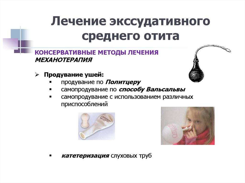 Лечение воспаления среднего уха у взрослых. Острый экссудативный отит средний симптомы. Экссудативный средний отит клиника. Экссудативный острый средний отит диагностика. Терапия экссудативного отита.