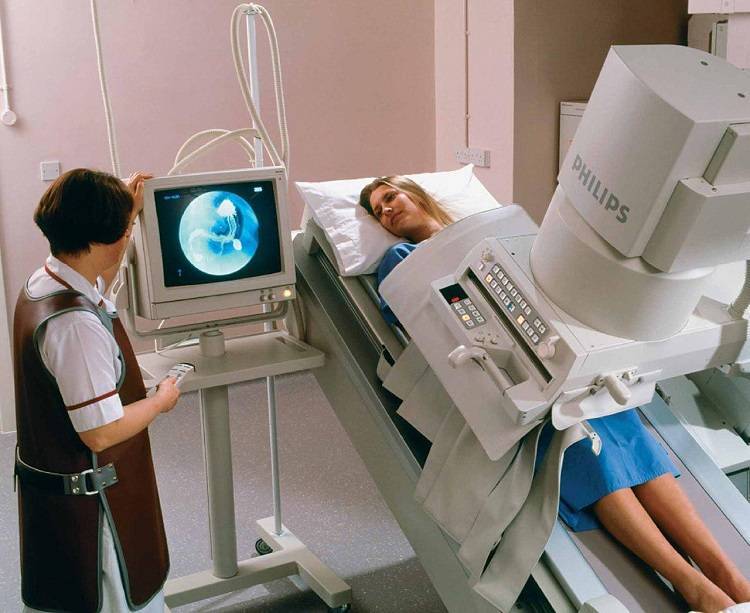 Рентгеноскопия пищевода и желудка с барием (контрастированием): как делают рентгенографию