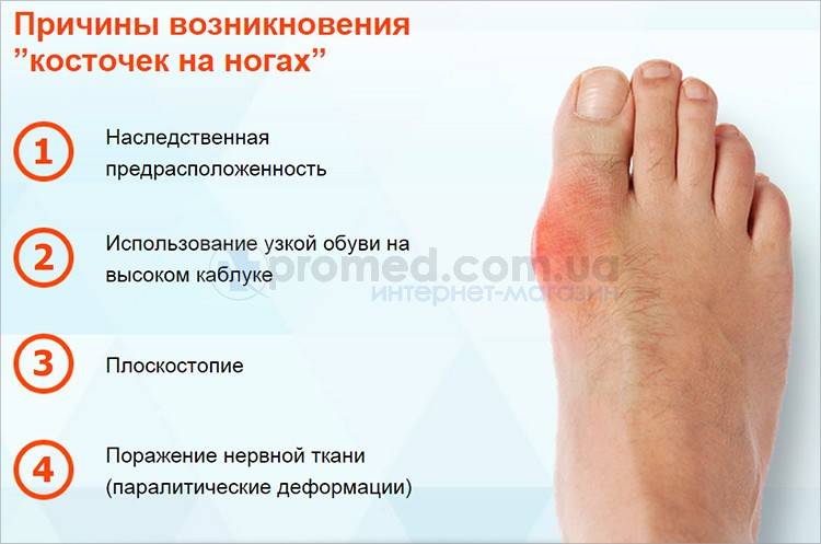 Острая боль в суставах большого пальца ноги