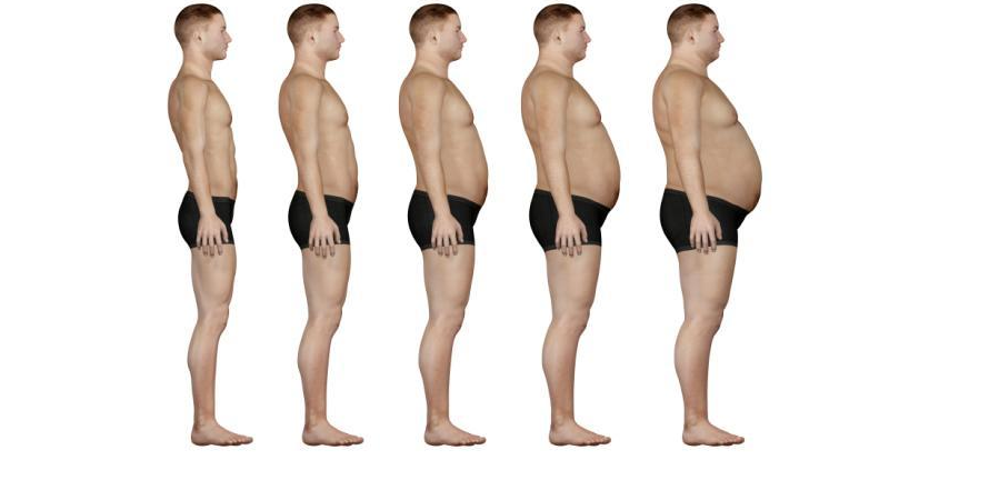 Что такое ожирение 1 степени. Ожирение 1 степени у мужчин. 1 Стадия ожирения у мужчин. Ожирение 1 степени вес. Ожирение 3 степени у мужчин вес.