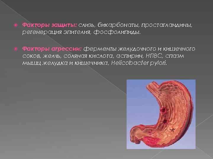 Язвенный гастрит желудка: лечение острой хронической язвенной болезни в спб