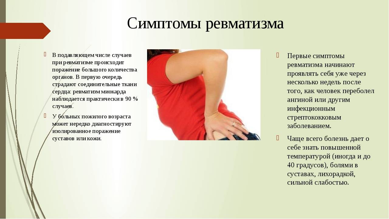 Сильная боль в суставах температура. Симптоматика ревматизма. Симптомы суставного ревматизма.