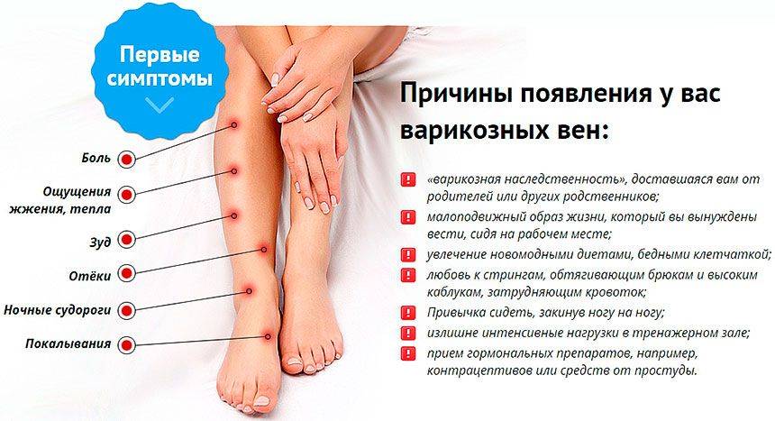 Боль в ногах (боль в нижних конечностях, болят ноги) - симптомы и лечение. журнал медикал