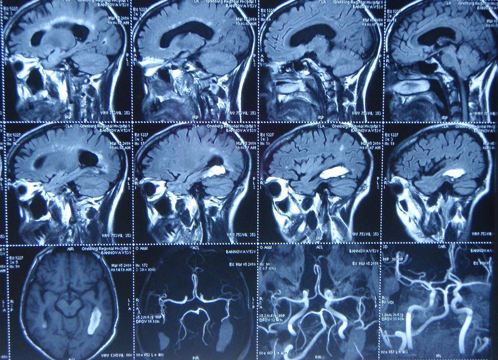 Мрт головы тамбов. Кт томограмма головного мозга. Компьютерная томография кт головного мозга. Мрт (магнитно-резонансная томография) сосудов головного мозга. Кт (компьютерная томография) сосудов головного мозга.