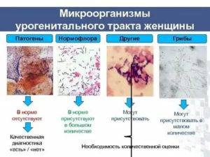 Дисбиоз с преобладанием условно патогенных анаэробных микроорганизмов: выраженный, умеренный кишечника, у женщин в гинекологии