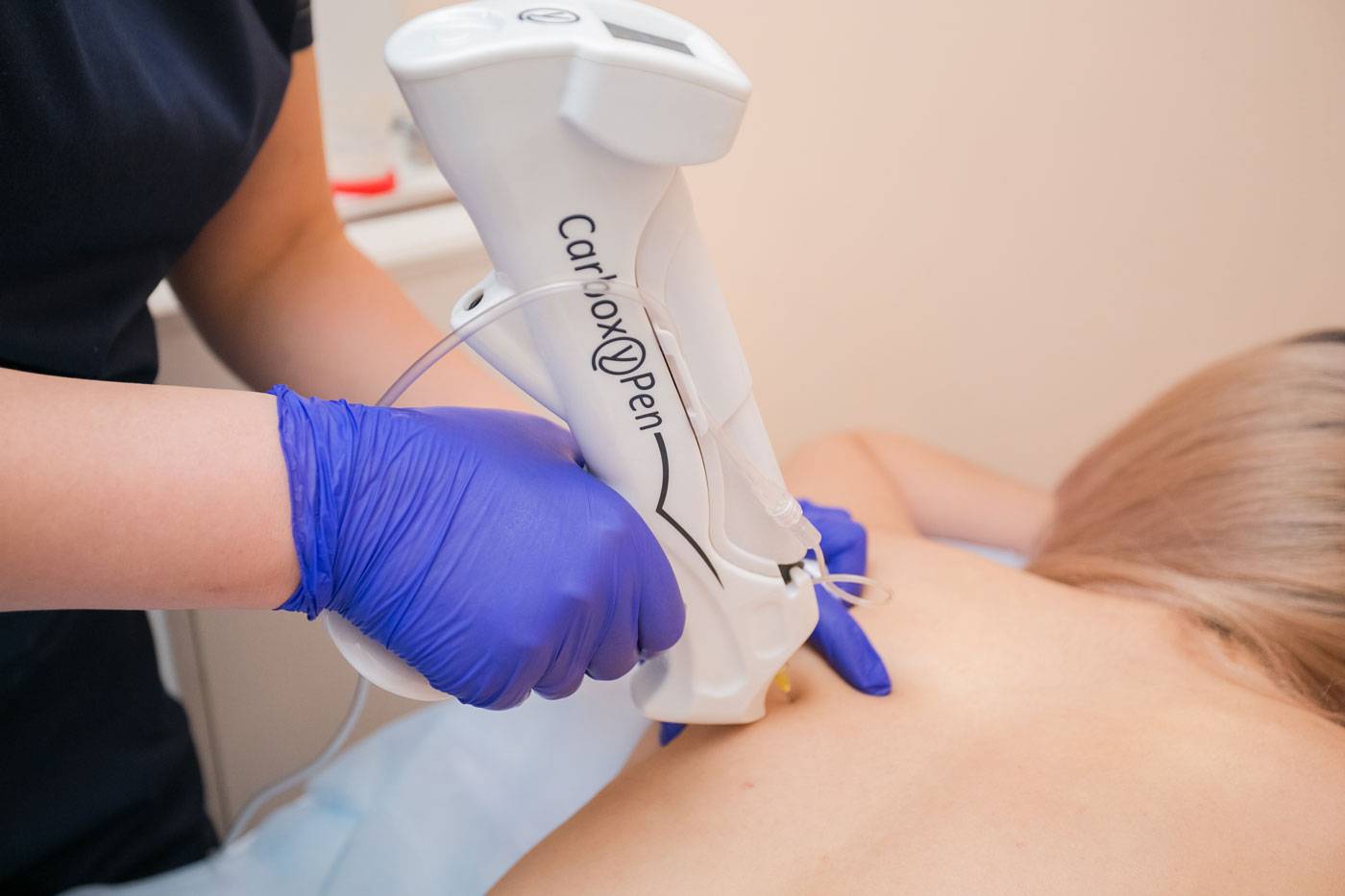 Карбокситерапия — газовые уколы для спины и суставов: отзывы и рекомендации