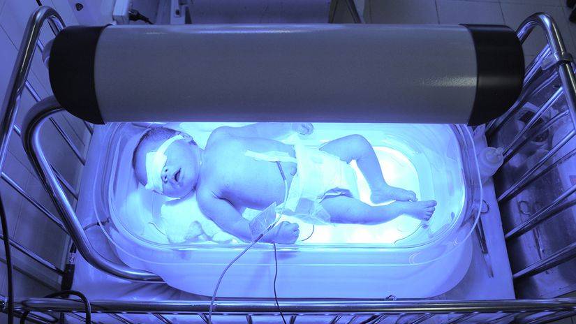 Лампа от желтушки для новорожденного: показания к фототерапии, виды для лечения новорожденных