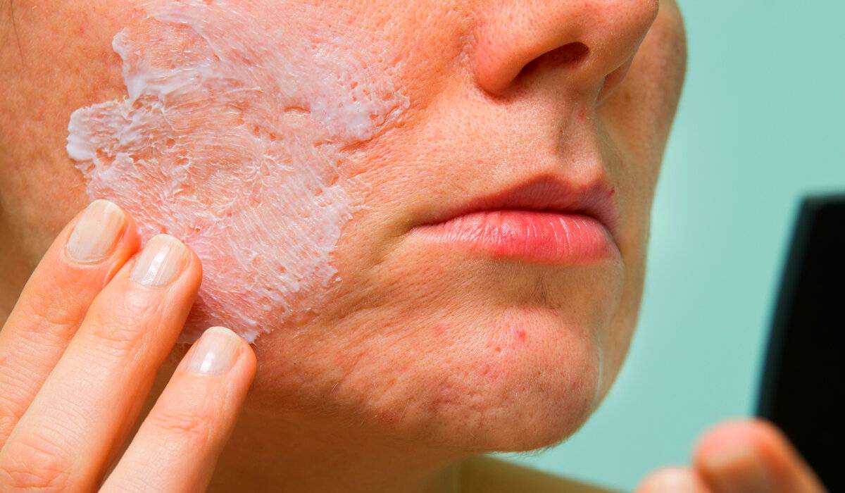 Почему шелушится и чешется лицо? основные причины зуда кожи и методы лечения